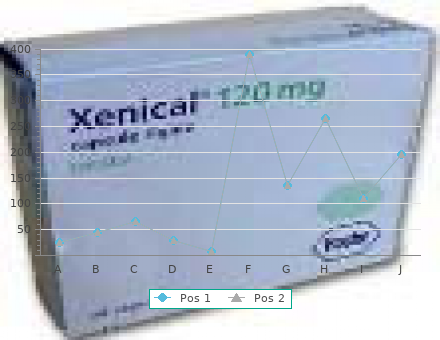 generic 80 mg super cialis amex