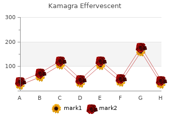 cheap kamagra effervescent 100mg line